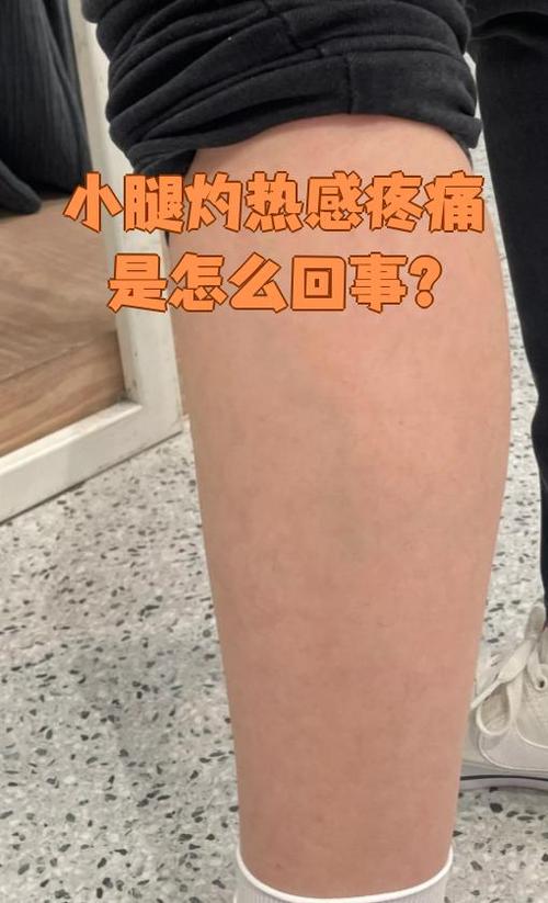 吃火锅后小腿肌肉酸痛缩略图