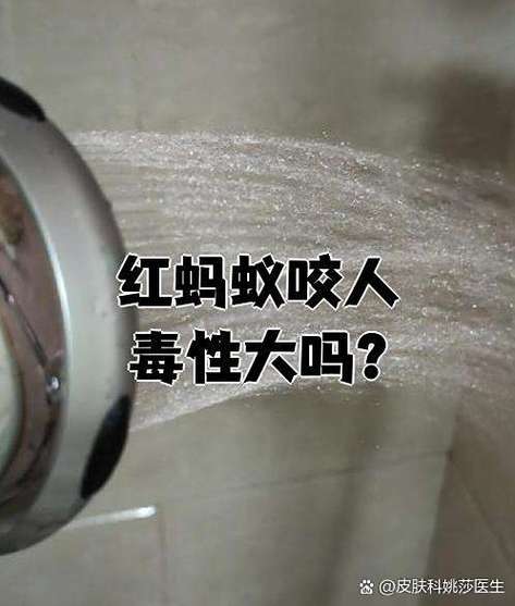 小红蚂蚁有毒吗缩略图