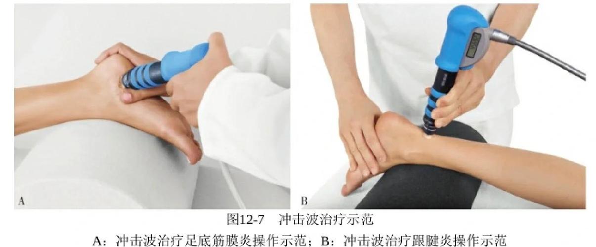 冲击波治疗多少钱一次缩略图