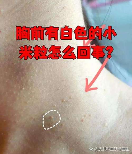 隔着皮肤摸到的颗粒缩略图