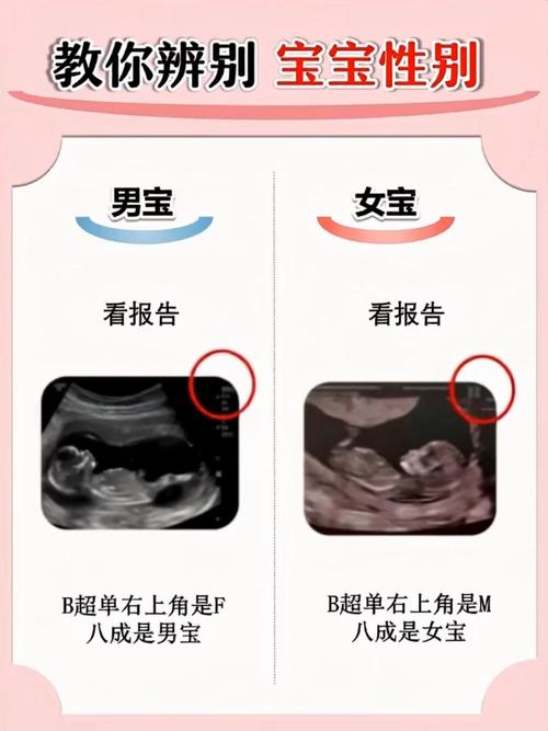 人类幼崽是男孩还是女孩缩略图
