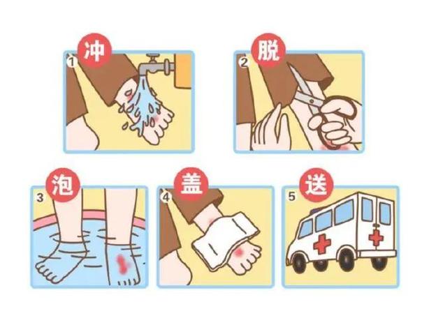 烫伤后该捂着还是晾着缩略图