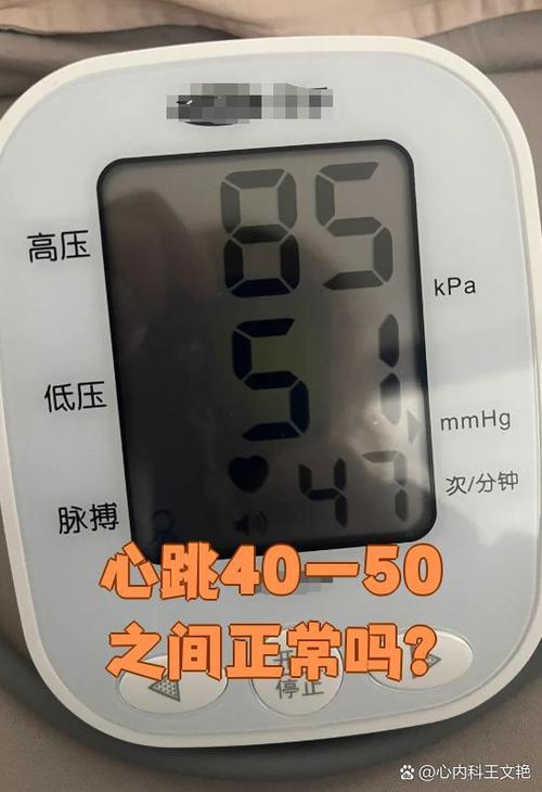 心率40-50有危险吗缩略图