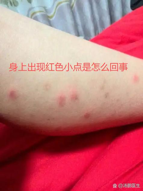 皮肤出现红色斑点缩略图