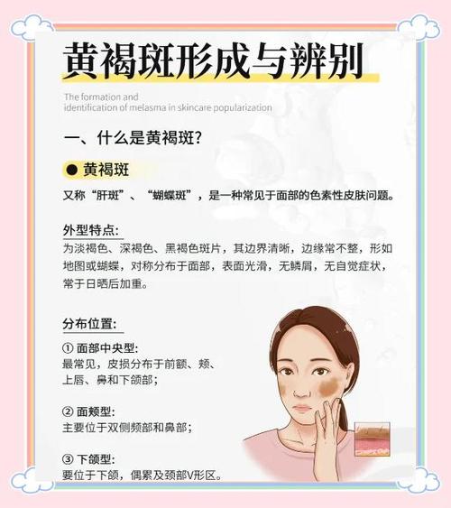 祛斑去医院挂什么科缩略图