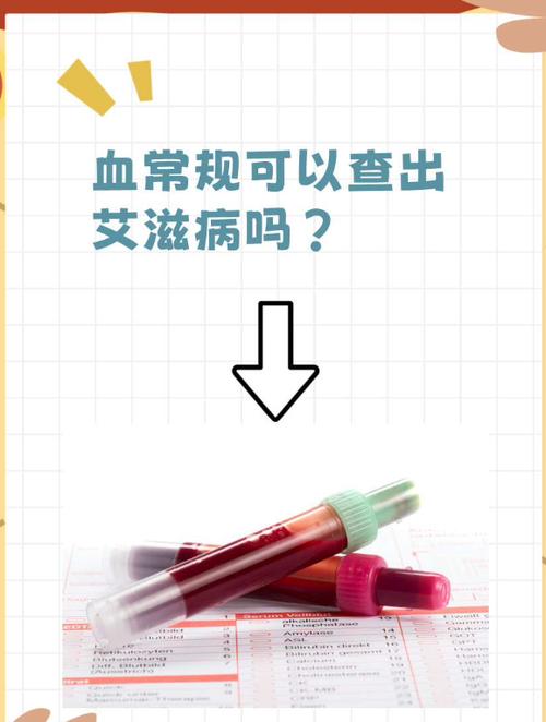 抽血能查出艾滋病吗缩略图