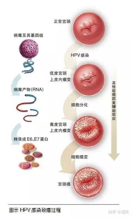 宫颈hpv39阳性是什么意思缩略图