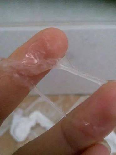 流白色的分泌物怎么回事缩略图