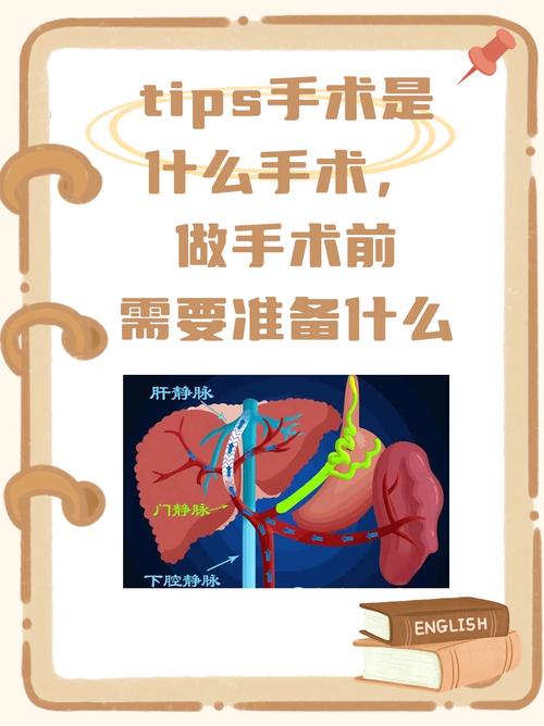sics手术全称叫什么缩略图