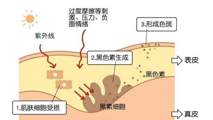 皮肤黑原因游戏截图