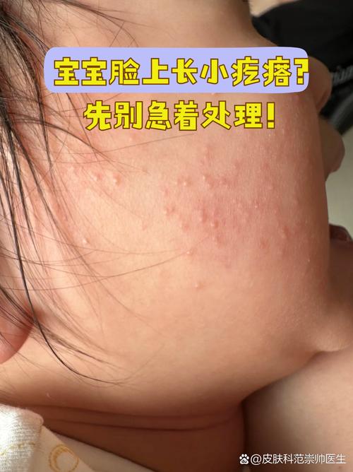 屁股上紫色疙瘩图片缩略图