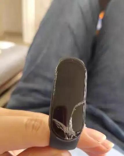 小米手环的维修方法缩略图