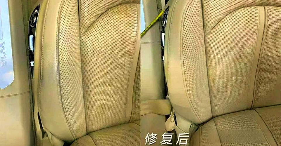 真皮磨损如何修复缩略图