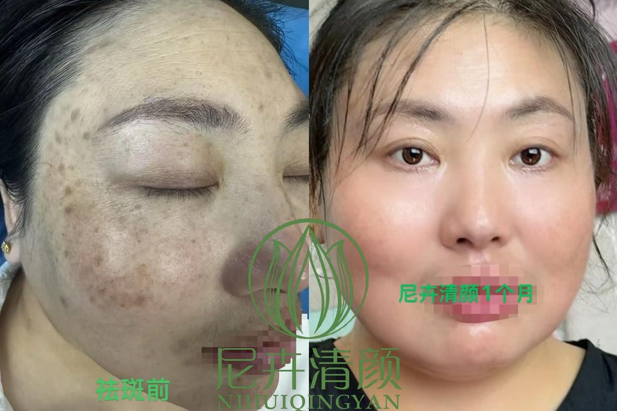 手机屏幕亮斑修复缩略图