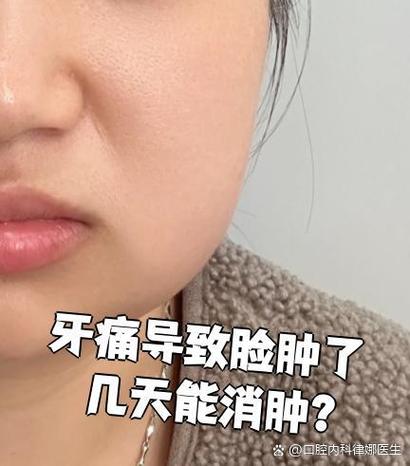 牙发炎脸肿了几天消肿缩略图