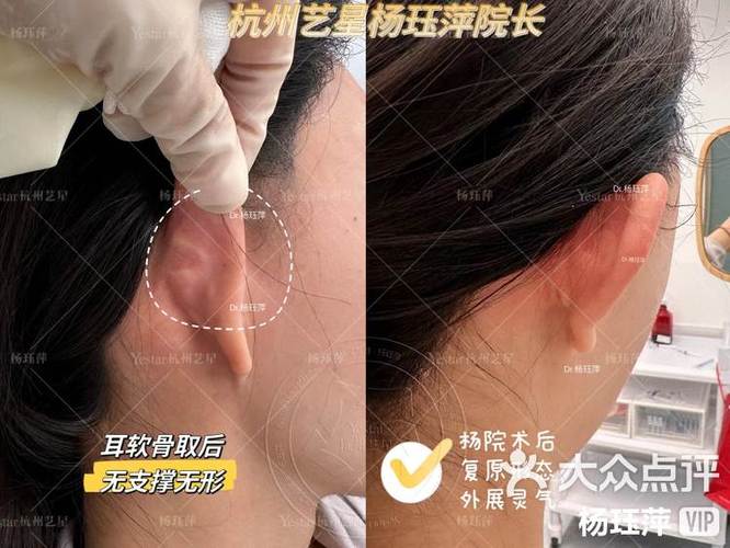 耳机音质突然变差缩略图
