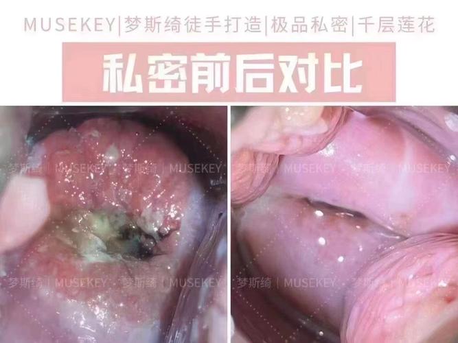 私密两侧长了疙瘩游戏截图