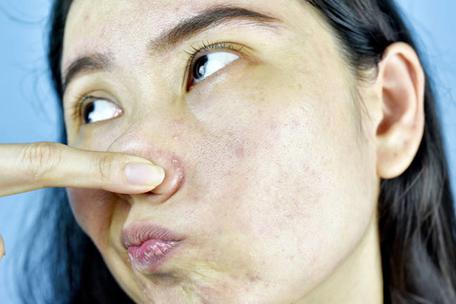 女生容易起生理反应缩略图