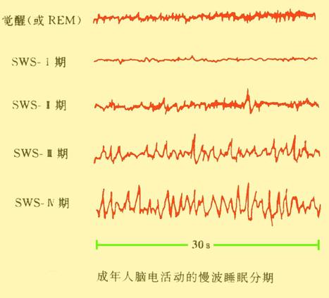 慢波睡眠和异相睡眠游戏截图