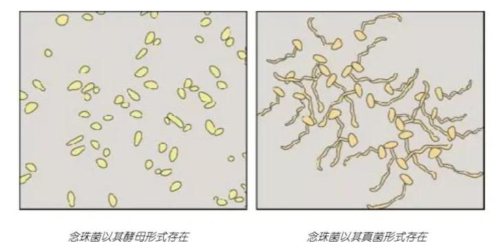 白色念珠菌感染缩略图