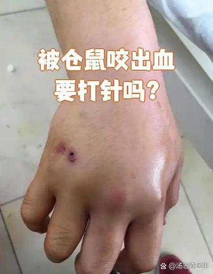 被仓鼠咬破了一点皮有事吗缩略图