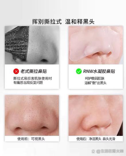 撕拉面膜撕不下来怎么办缩略图
