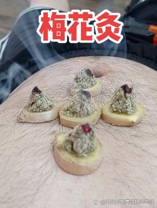 倪海厦中脘梅花灸游戏截图
