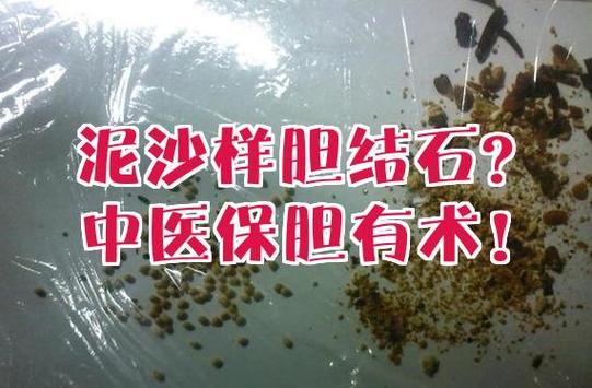 胆囊结石吃什么药能消除缩略图