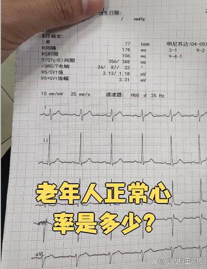70-80岁心率55_60是正常吗游戏截图