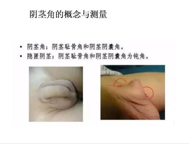 王者荣耀怎么让好友看不见自己在线缩略图