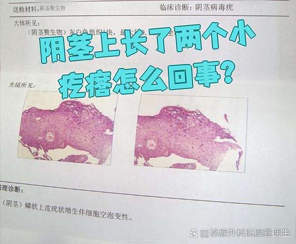 小鸡上长疙瘩了怎么回事缩略图