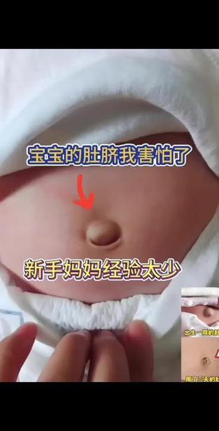 肚脐上面一吃饭就鼓起来缩略图