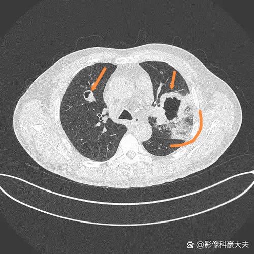 肺部有肿瘤怎么办游戏截图