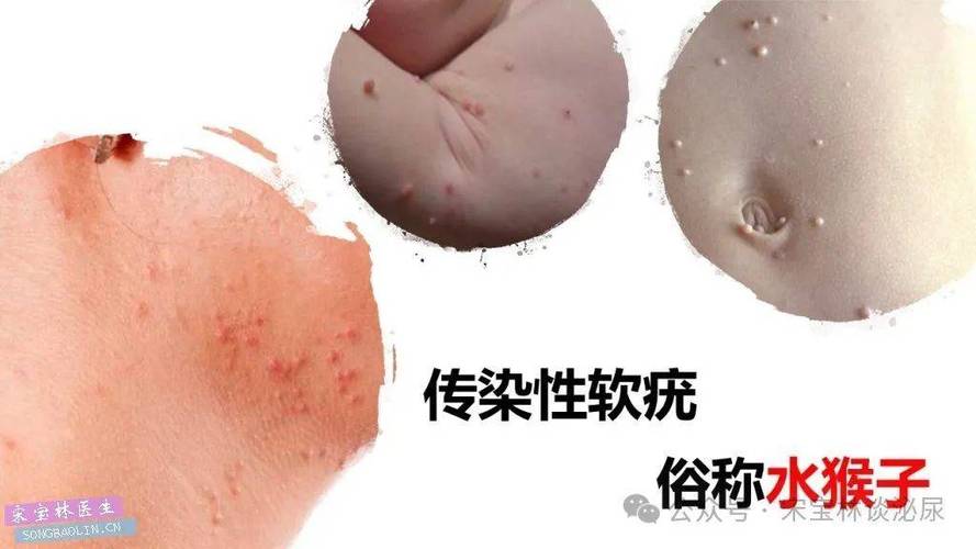 水猴子皮肤病图片游戏截图